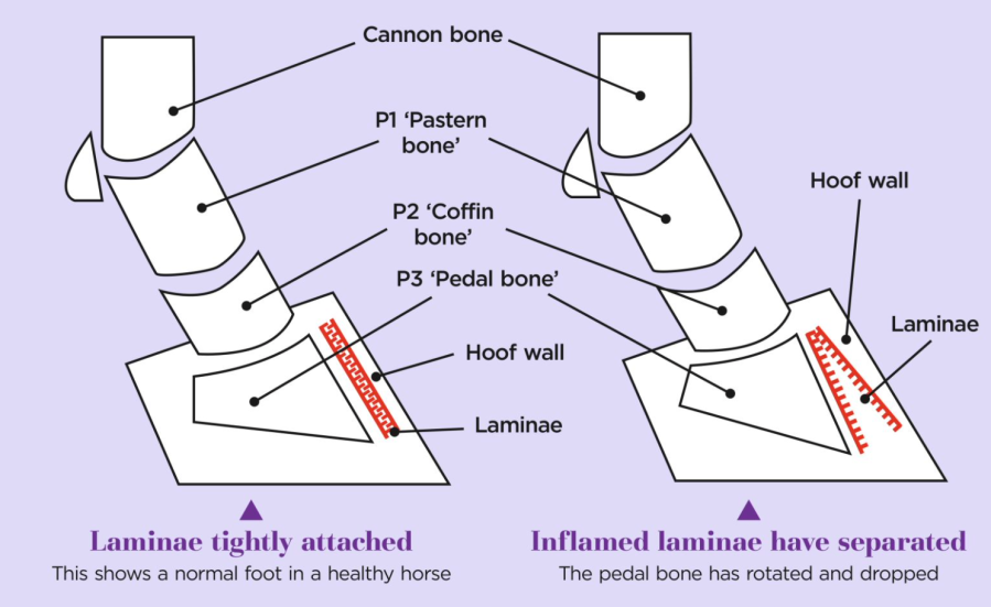 Diagram shows the change in laminae and pedal bone position from a healthy hoof to the hoof of a horse with laminitis